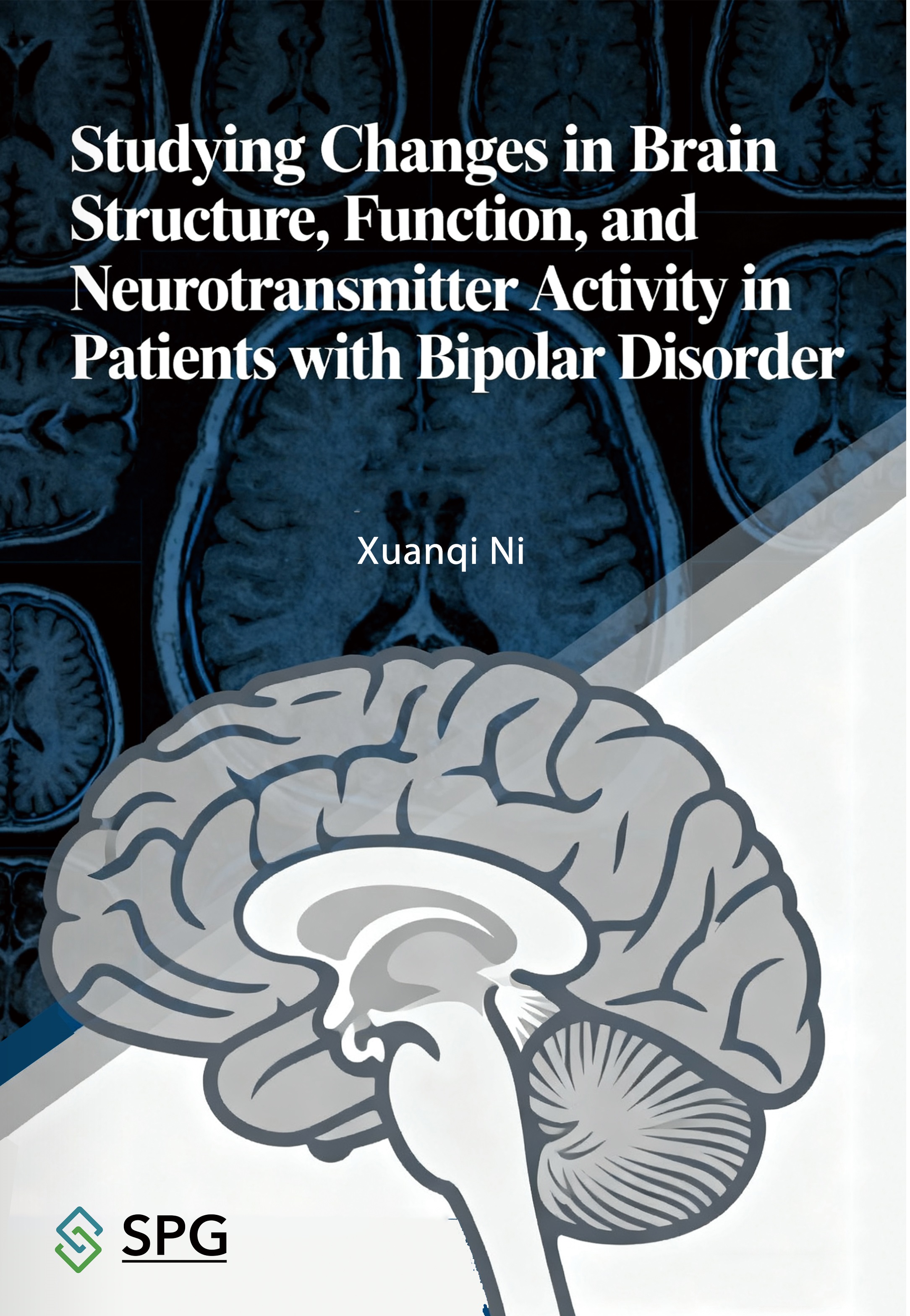 Studying Changes in Brain Structure, Function, and Neurotransmitter Activity in Patients with Bipolar Disorder | Scholar Publishing Group