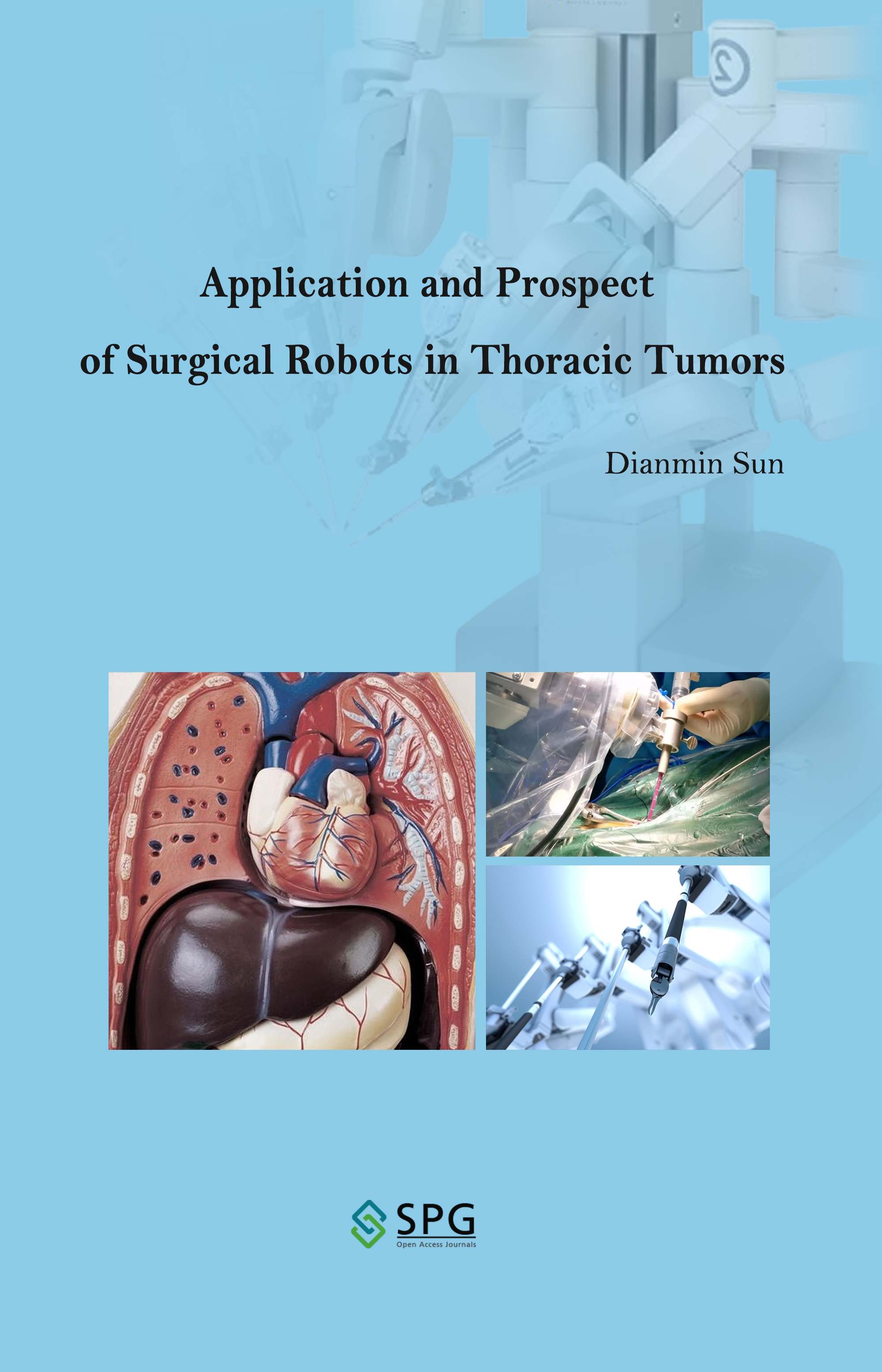 Application and Prospect of Surgical Robots in Thoracic Tumors | Scholar Publishing Group